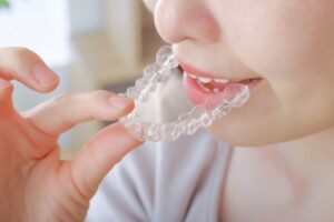 マウスピースを装着しようとしている女性の写真